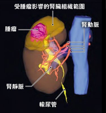3D醫學影像重建技術示意圖