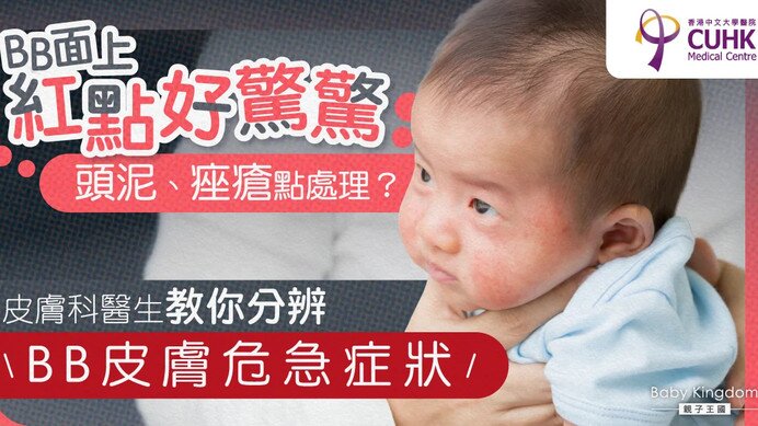 新手爸媽要知4大常見皮膚問題 皮膚科醫生教分BB皮膚危急症狀