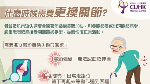什麼時候需要更換關節?