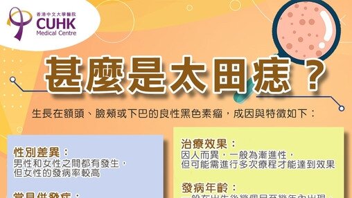 甚麼是太田痣？