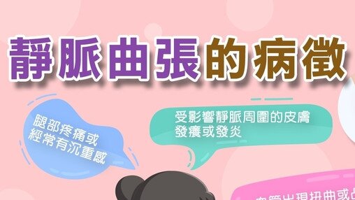 靜脈曲張的病徵