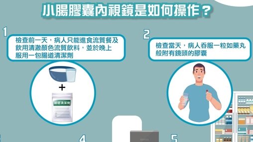 小肠胶囊内视镜