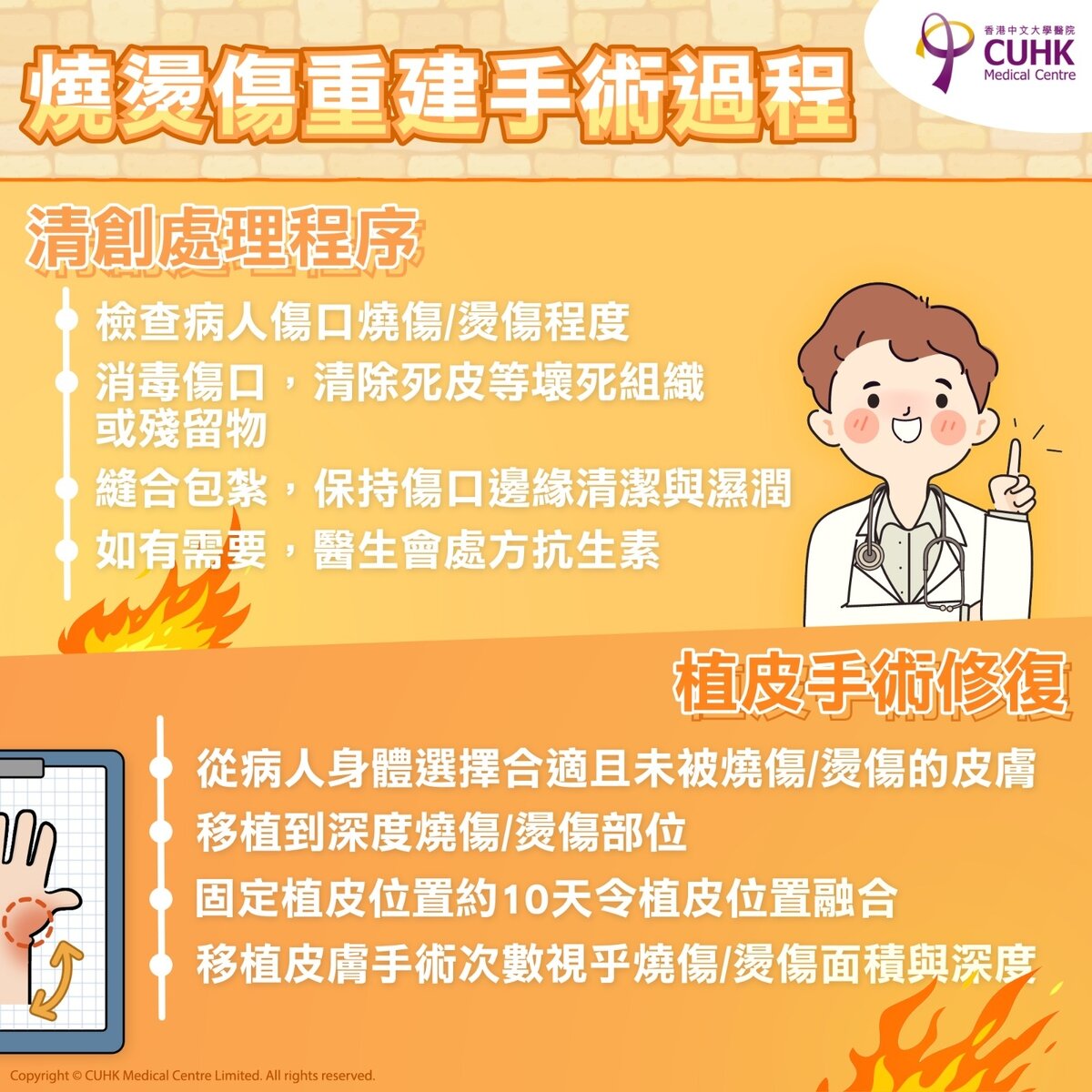 小腸膠囊內視鏡