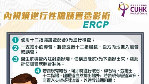 胆结石与 ERCP
