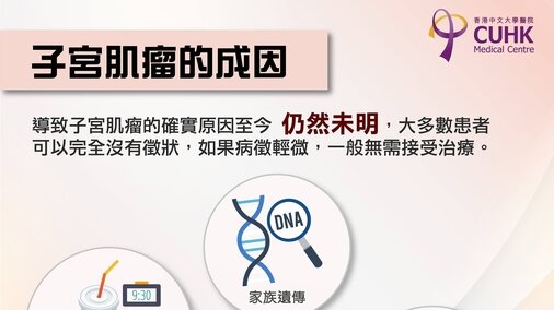 子宮肌瘤的成因