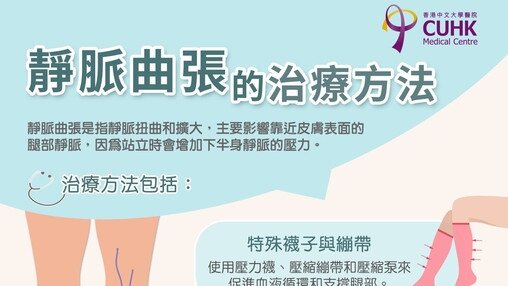 靜脈曲張的治療方法