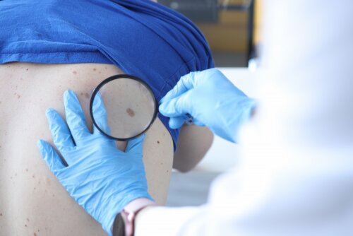 醫生檢查病人皮膚狀況圖片