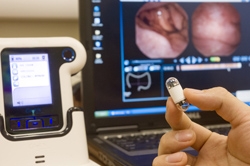 Image of Colon Capsule Endoscopy 大腸膠囊內視鏡相片