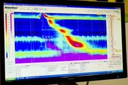 Image of High resolution esophageal impedance manometry (HRIM) 高解像食道阻抗及壓力檢查相片